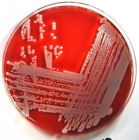 arthrobacter agar aureus blood brevibacterium diameter 2mm grown colonies shown those above form yellow similar when weebly